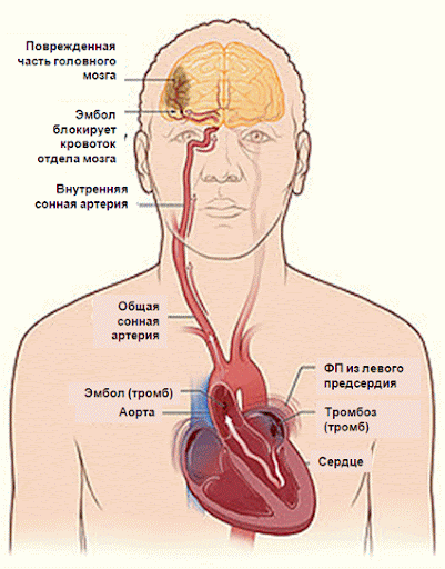 Как связаны сердце и мозг