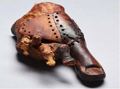 Древнеегипетский протез пальца ноги   (https://www.kp.ru/daily/26695.4/3719431/?ysclid=ly5jenrg1d322986760)
