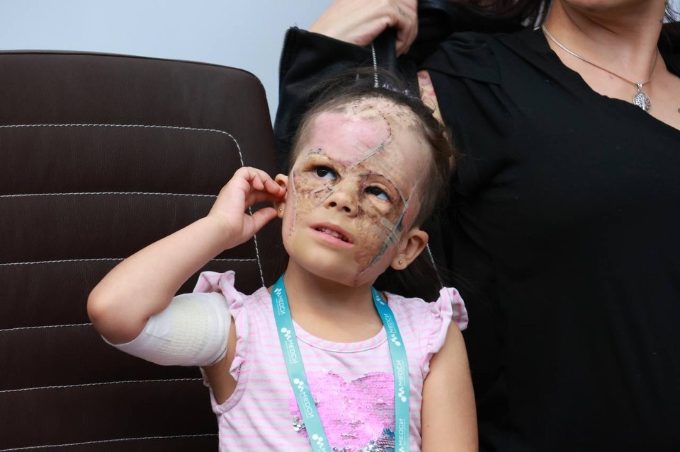    Врачи показали лицо девочки «с маской Бэтмена» после операции в Петербурге. Вероника ОВСЯННИКОВА