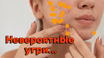 Почистили лицо парню, особенно за ухом!