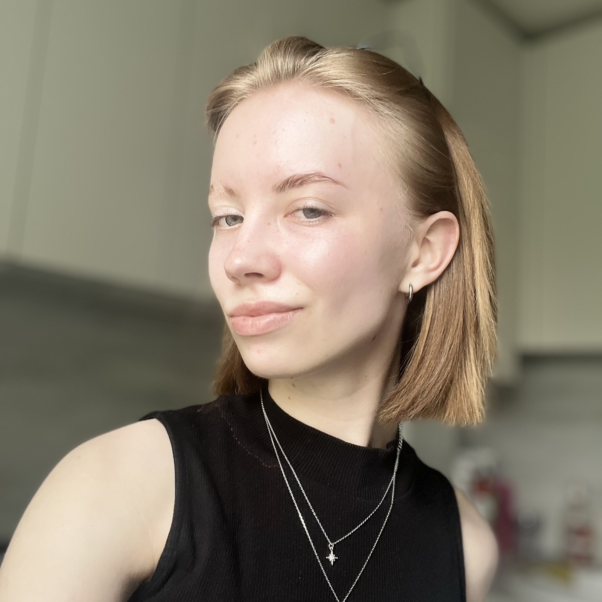 Фотография после двух недельного ухода, где имеются ещё несовершенства