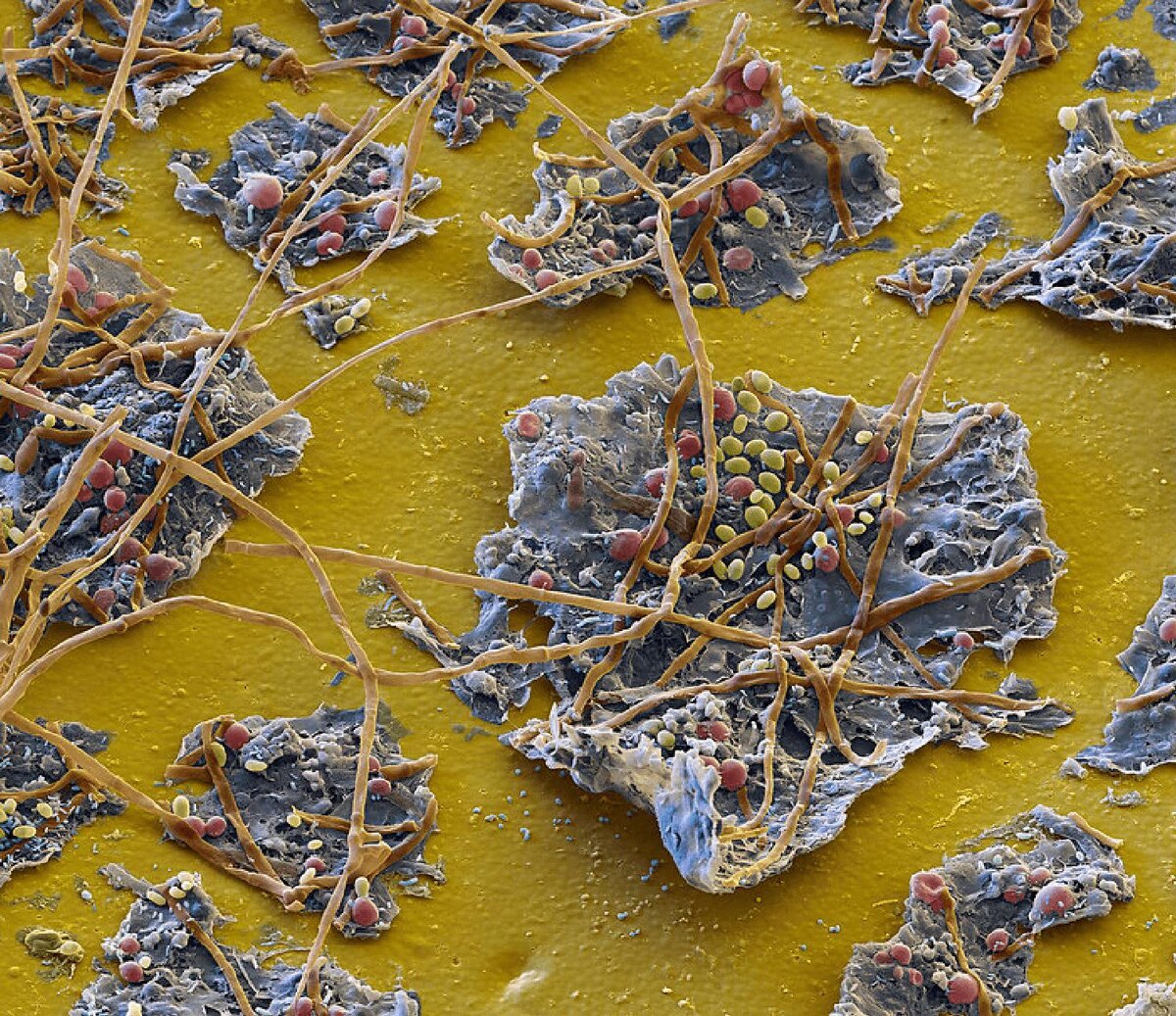 Микроорганизмы на поверхности изделия. Хорошо видно плесень (длинные коричневые нити) и дрожжи (красные и жёлтые округлые клетки). Электронный микроскоп. Увеличение: x1000 раз. 