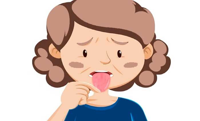 Ксеростомия - это сухость во рту