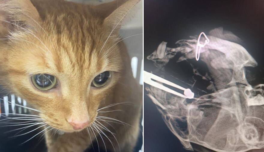 При исследовании в пазухе носа Кузи обнаружили металлическую пулю от пневматики