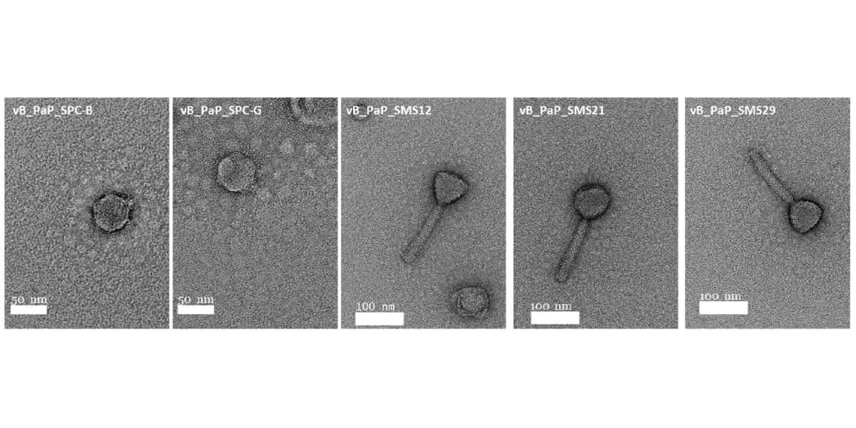    Просвечивающая электронная микроскопия вирионов различных бактериофагов синегнойной палочки / © Pinto, A.M et al., Antibiotics, DOI:10.3390/antibiotics10070877