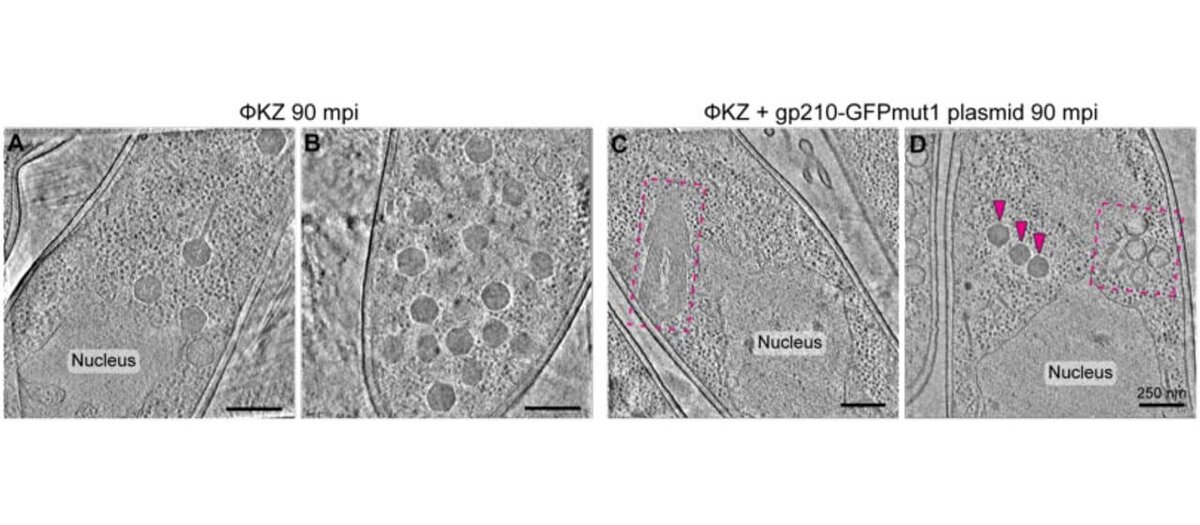    Томография (Cryo-FIB-ET) синегнойной палочки (P. aeruginosa), зараженной бактериофагом ΦKZ: слайды A и B — контрольный образец, слайды C и D — в бактерии одновременно с ΦKZ присутствует самонаводящяяся эндонуклеаза gp210. Словом Nucleus помечено не клеточное ядро (у бактерий его почти никогда нет), а специальная подобная ядру белковая структура, которую формируют джамбо-фаги для защиты от иммунного ответа бактерии. Когда gp210 нет, капсиды ΦKZ активно формируются (шарообразные структуры), когда эндонуклеаза присутствует, процесс размножения вируса нарушен. Пурпурными стрелками показаны немногочисленные капсиды правильной формы, пурпурным пунктиром обведены деформированные неправильно растущие капсиды / © Erica A. Birkholz et al., Science, DOI:10.1126/science.adl1356