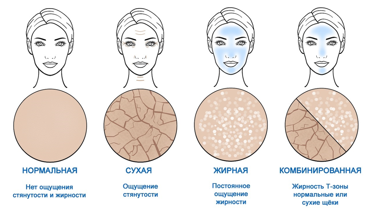 Типы кожи