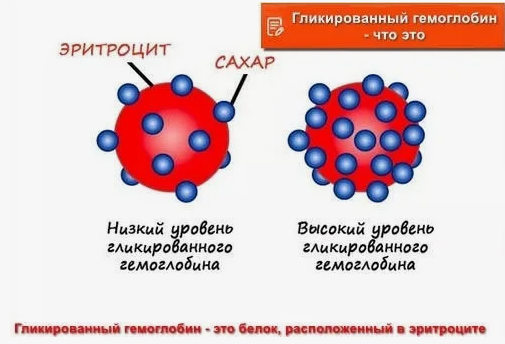 Эндокринолог Ольга Павлова рассказывает в своём телеграм-канале много интересного. Например, недавно выложила пост о том, что является маркёром диабета или преддиабетного состояния.-2