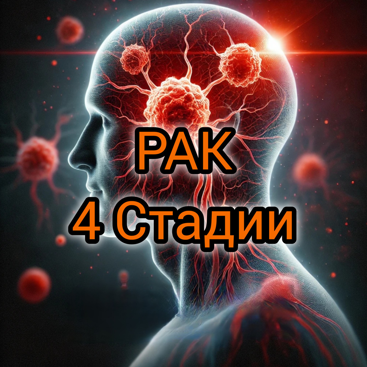 Рак 4 Стадии: Что Это Такое?