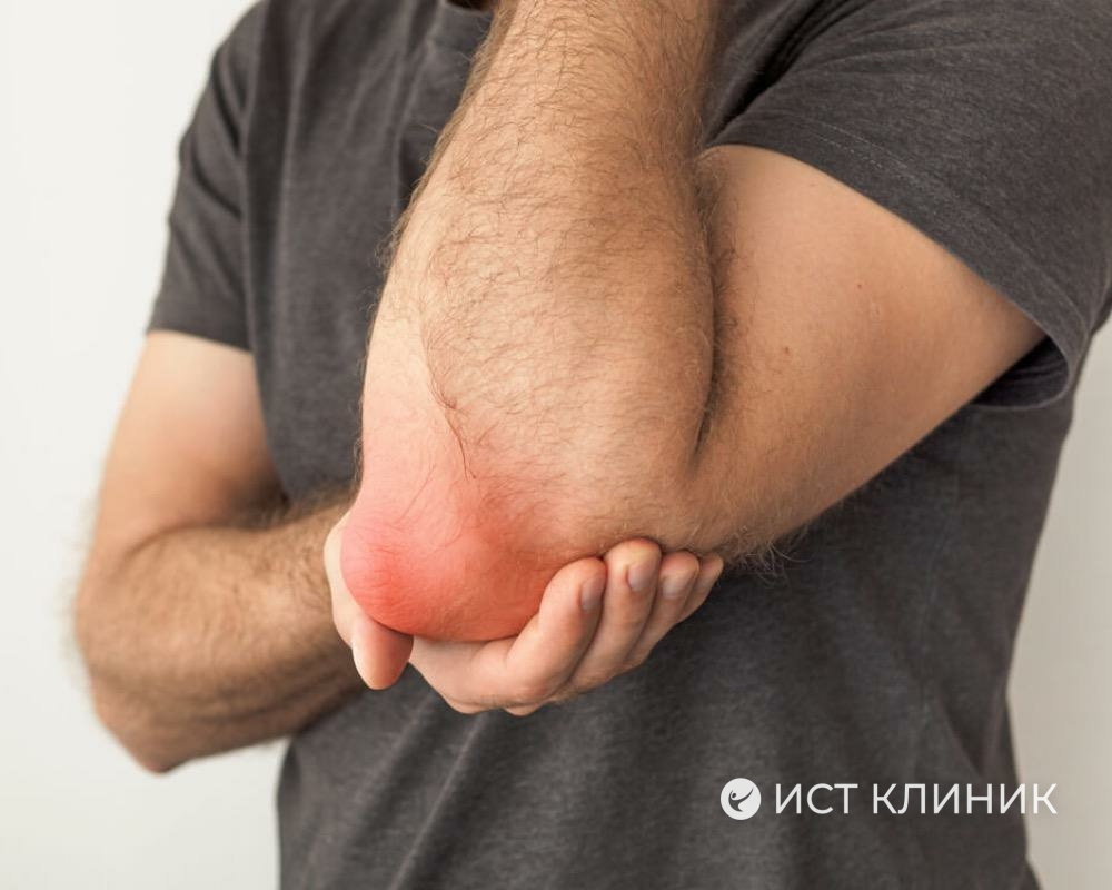 Нарушения метаболизма (сахарный диабет, атеросклероз, ожирение) способствуют возникновению бурсита