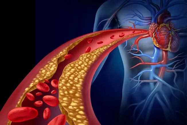 Заболевания сердечно-сосудистой системы Есть хорошие новости для группы крови O. Исследования показывают, что риск ишемической болезни сердца, как правило, ниже. Эксперты не уверены, почему.