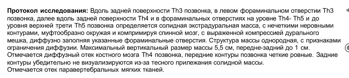 Скрин из выписки