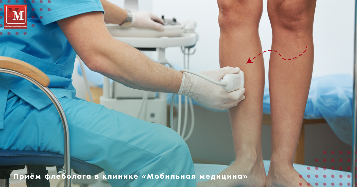 УЗИ вен нижних конечностей проводят стоя!