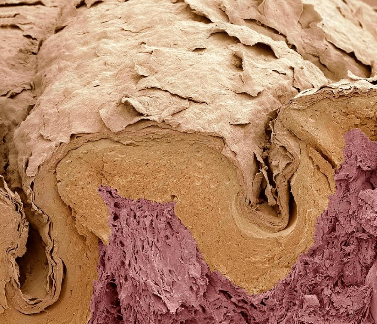 Срез кожи, на котором видно поверхность эпидермальных гребней (серый цвет). Электронный микроскоп. Увеличение: x150 раз.