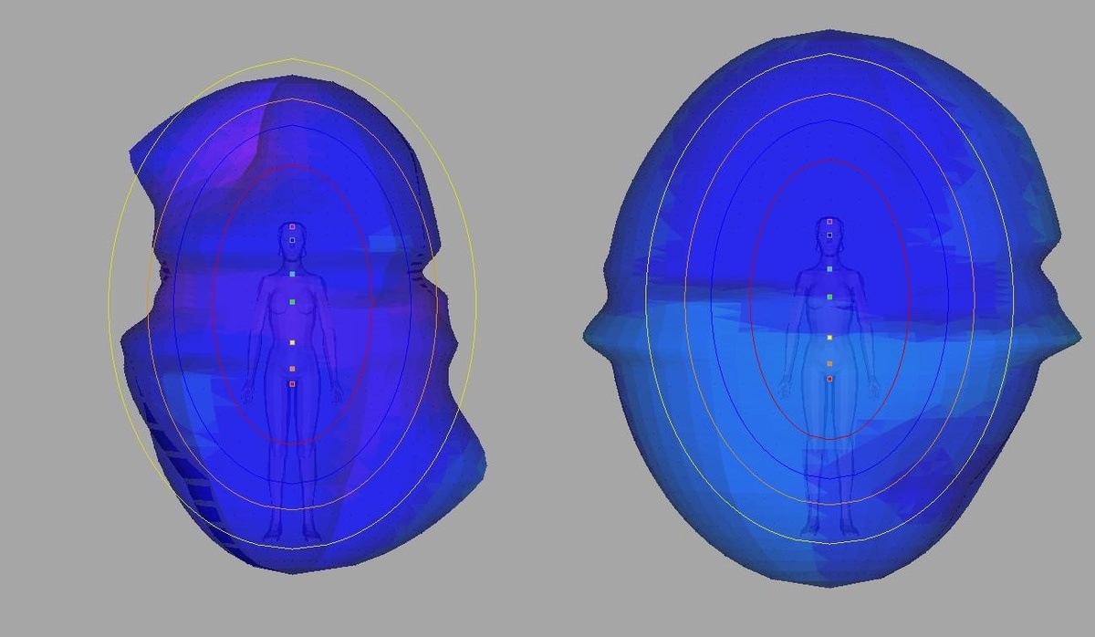 Диагностика в программе Адаптометрия до и после курса Зеркал