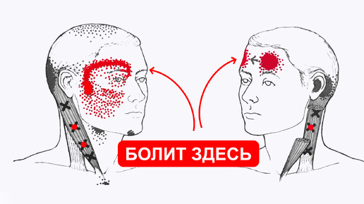 Головная боль в затылке и во лбу