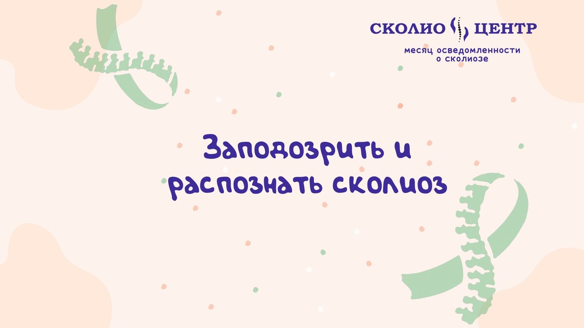Как распознать сколиоз?