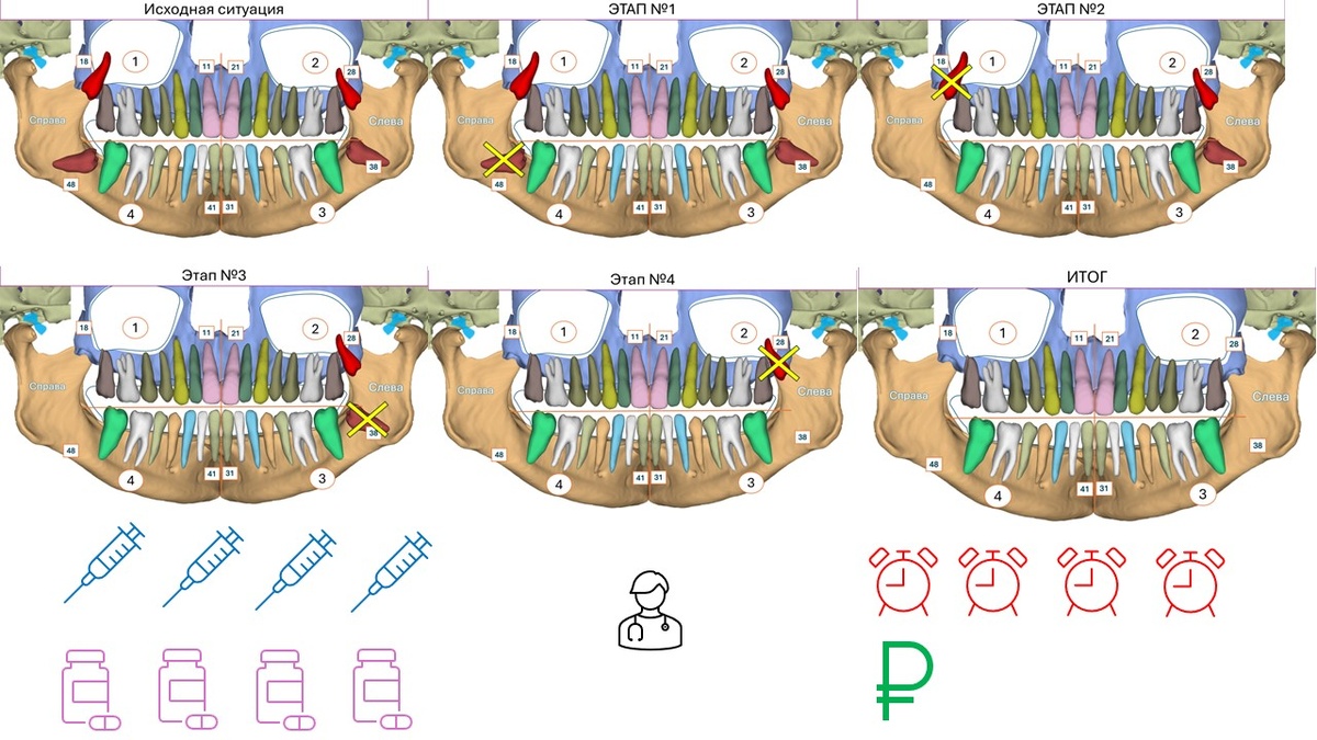 Много анестезий, много этапов, много антибиотиков и затраченного времени