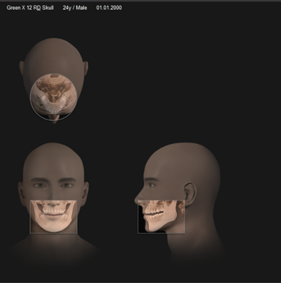 Режимы захвата на компьютерном томографе Green X12