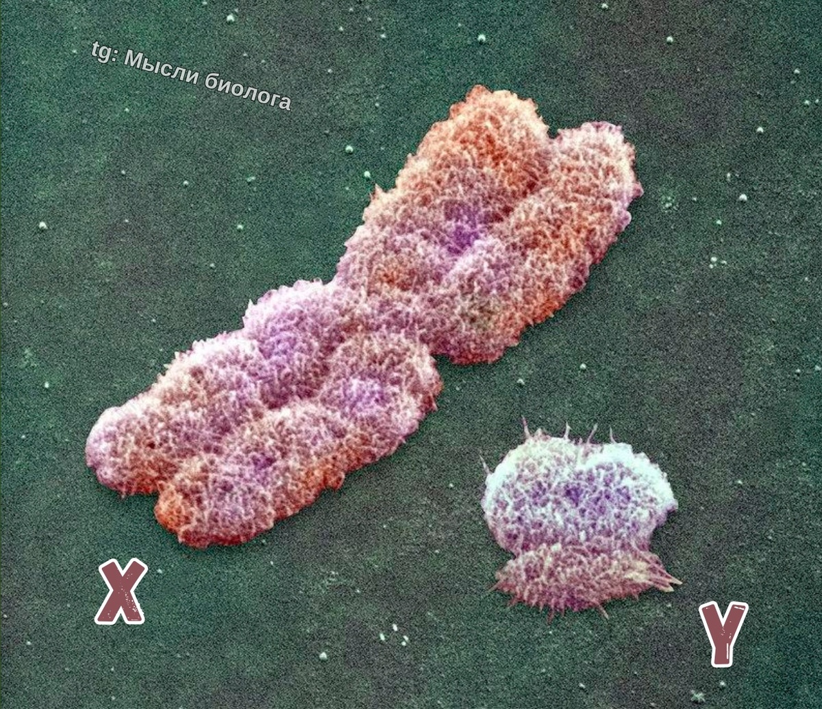 Половые хромосомы человека. Увеличение: x7200 раз. Электронный микроскоп