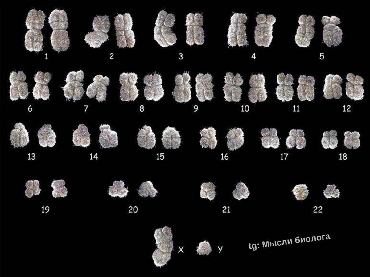 Полный набор хромосом (кариотип) человека.