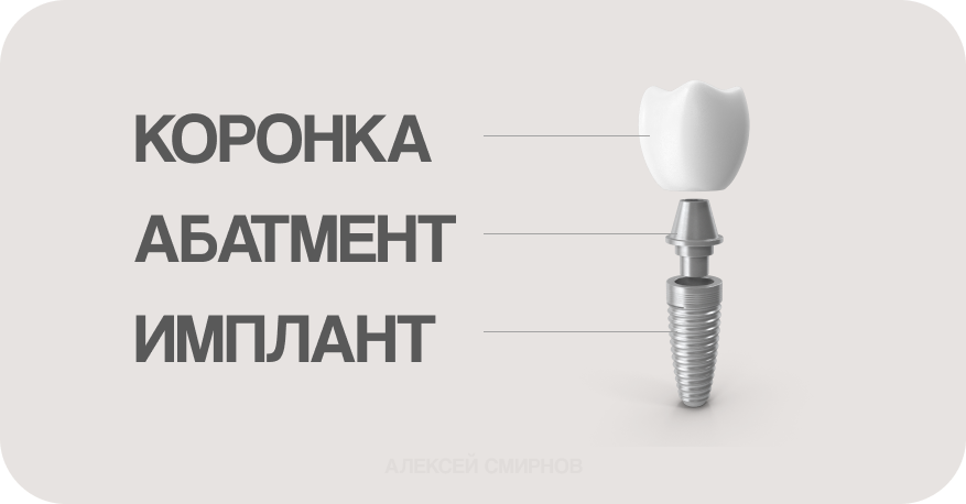 Составные части импланта