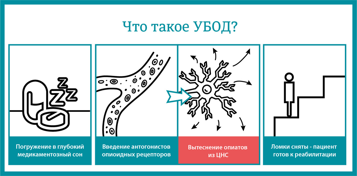 Что такое УБОД