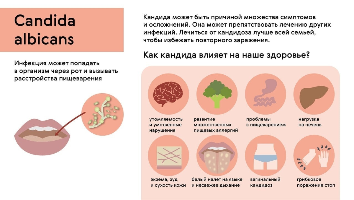 Молочница: почему она повторяется и как ее можно вылечить? | О здоровье: с  медицинского на русский | Дзен