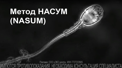 🔬 Метод НАСУМ (NASUM) - инновационный метод клиники «АльтраВита» #сперматозоид #репродукция #эко