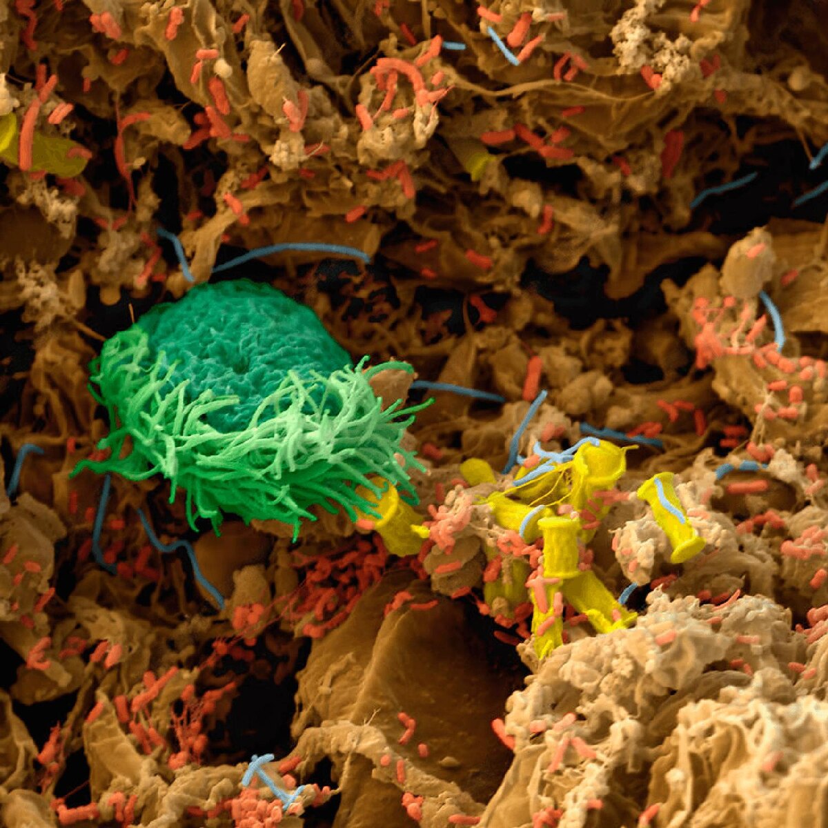 Инфузория (зелёная) и бактерии (красный цвет), а также червь нематода (2 фото) внутри компостной кучи. Электронный микроскоп.