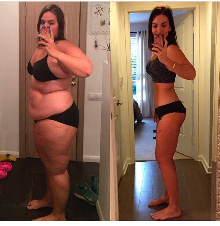 Не думаю что без косметических операций можно было добиться такого результата, тк как минимум, кожа никуда бы не делась...