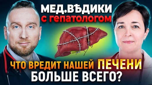 Как распознать ПРОБЛЕМЫ С ПЕЧЕНЬЮ без похода к врачу?