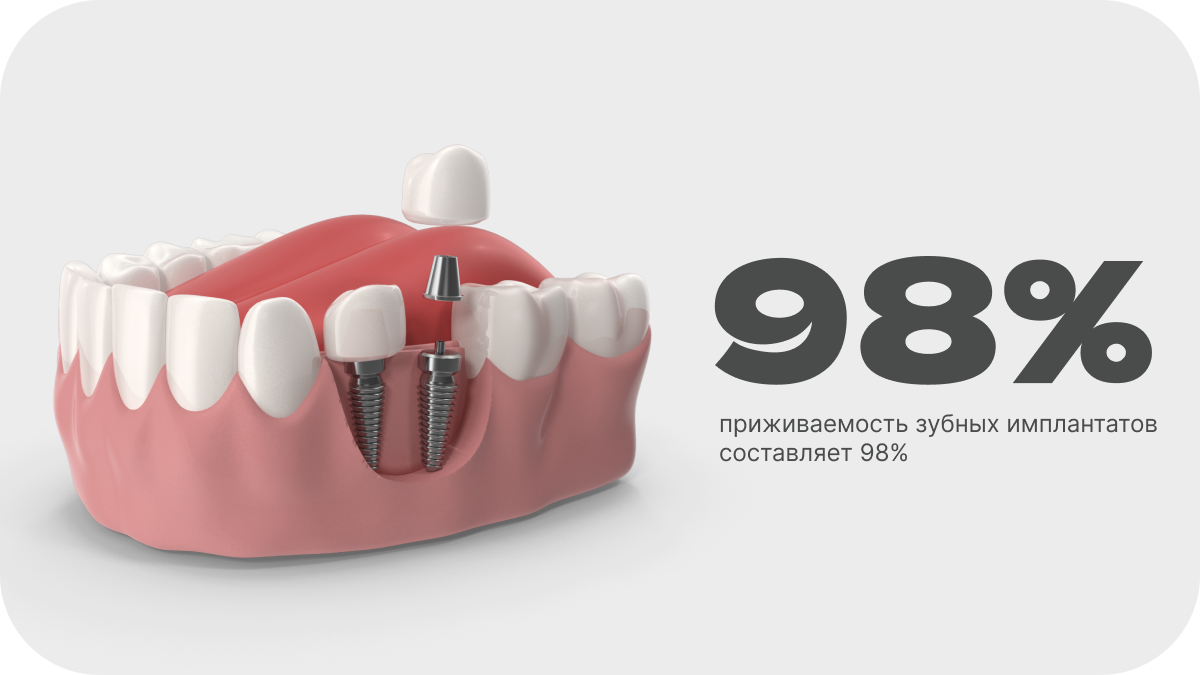 Процент приживаемости зубных имплантов
