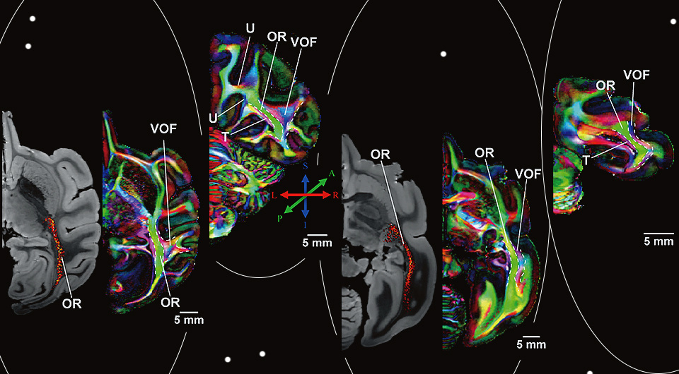   N + 1; Hiromasa Takemura et al. / Current Biology, 2024