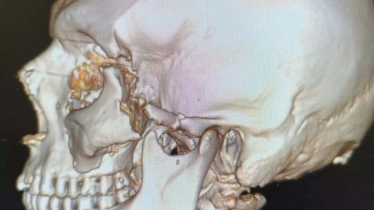     Источник: https://vk.com/wall-33139512_5651