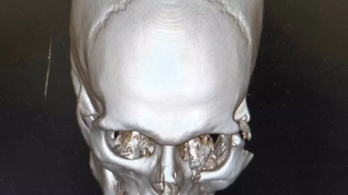     Источник: https://vk.com/wall-33139512_5651