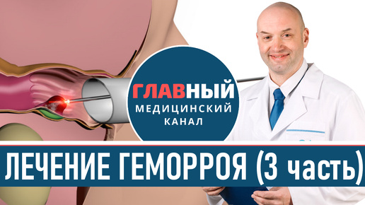 Геморрой у женщин и мужчин. Внутренний геморрой после родов и при беременности