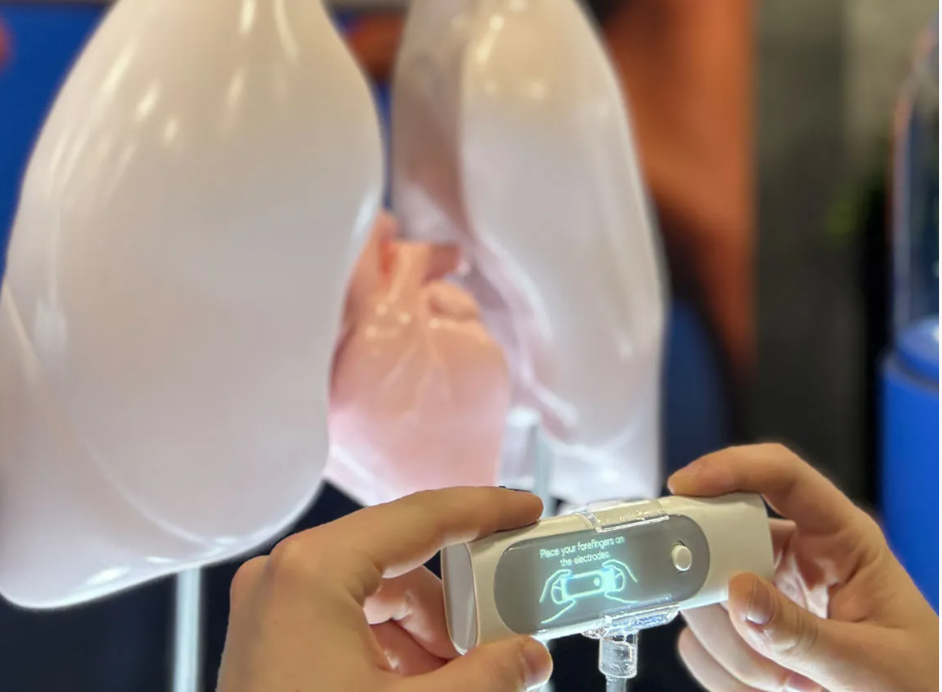 Многофункциональное устройство для здоровья: Withings BeamO