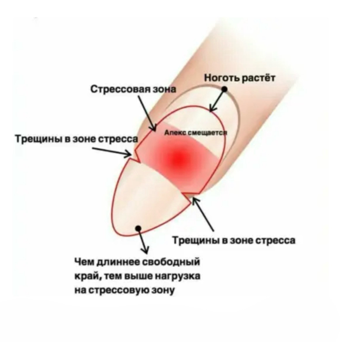 Ошибки, которые может совершать мастер. Чаще всего трещины появляются в зоне стресса ногтя (смотри фото ниже).-2