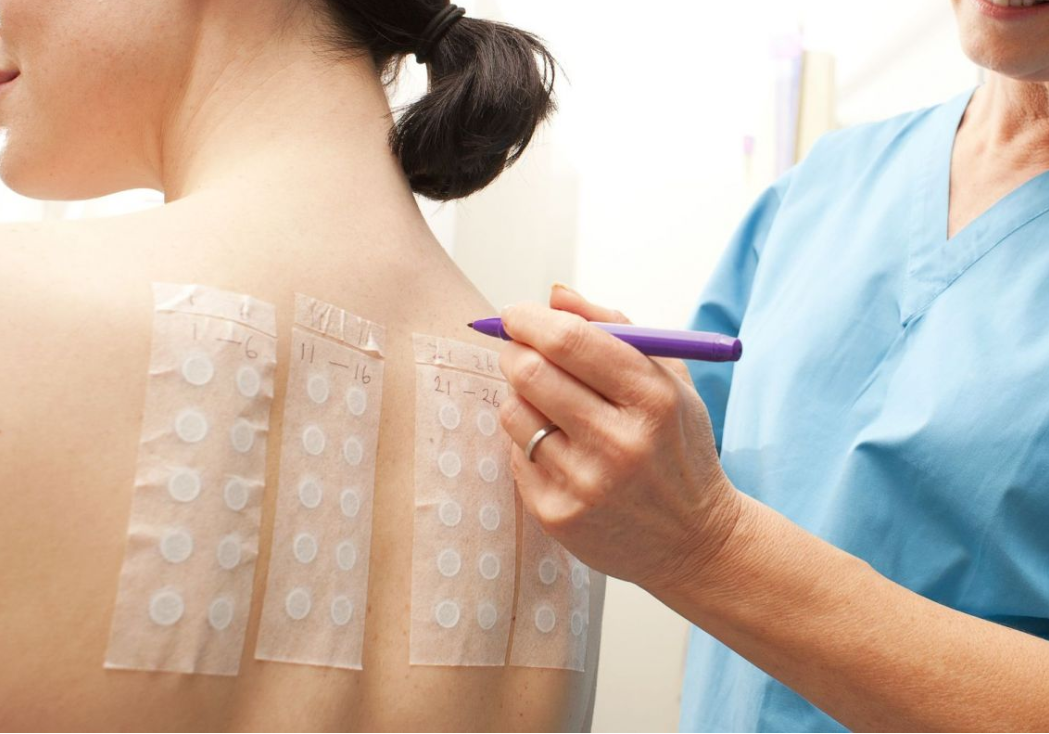 Проведение патч-теста на аллергию