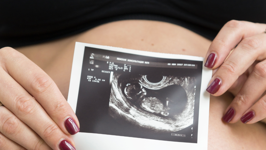    Aleksey Smyshlyaev/Globallookpress