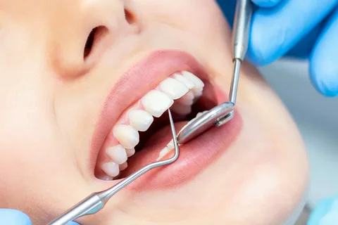 В России одной из самых востребованных стоматологических услуг является установка пломбы на зуб или протезирование.