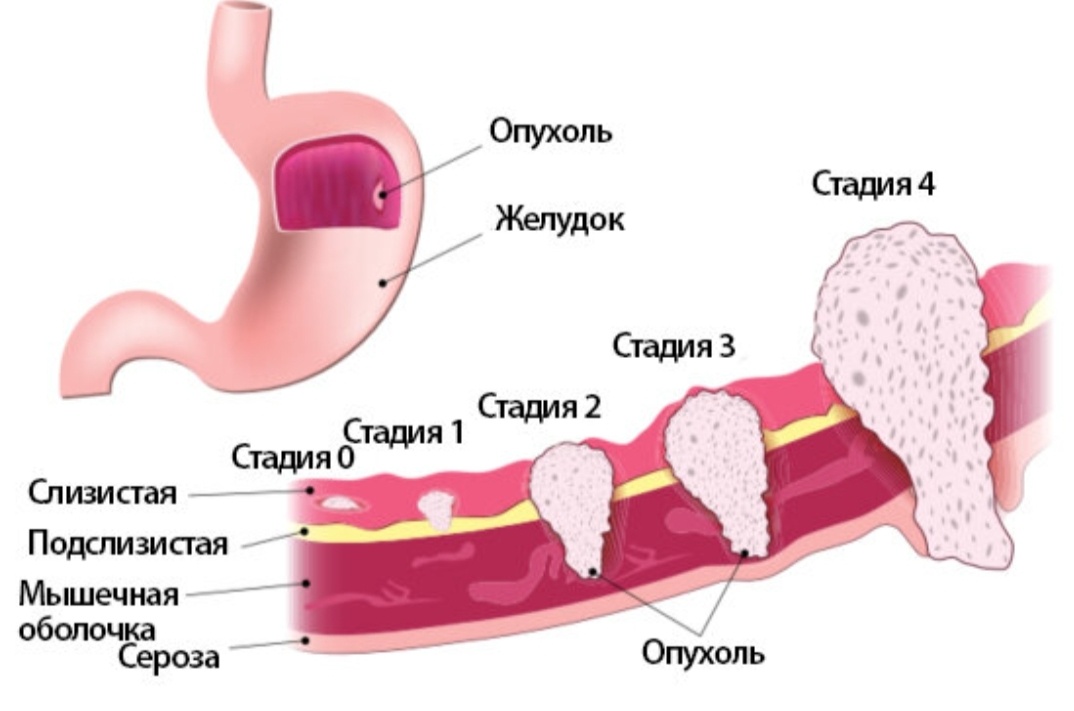 Желудочный стол