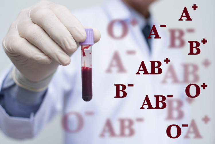 Ученые провели новое исследование, которое выявило группу крови, связанную с возможным снижением интеллекта, сообщает болгарский портал Flagman.
