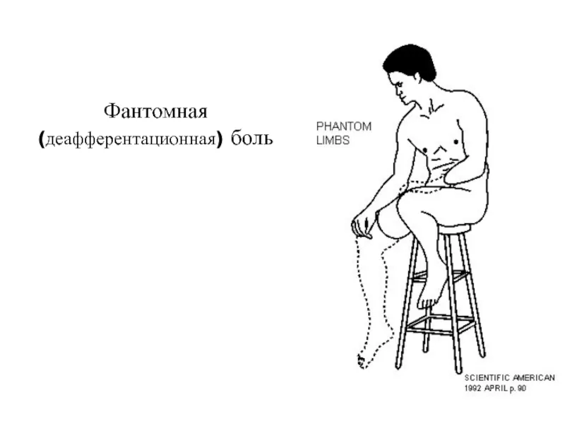 Иногда у взрослых возникают фантомные боли. Это особый вид ощущений, когда болит отсутствующий орган или конечность. Связана проблема с особенностями работы мозга, и она требует помощи врачей.-2