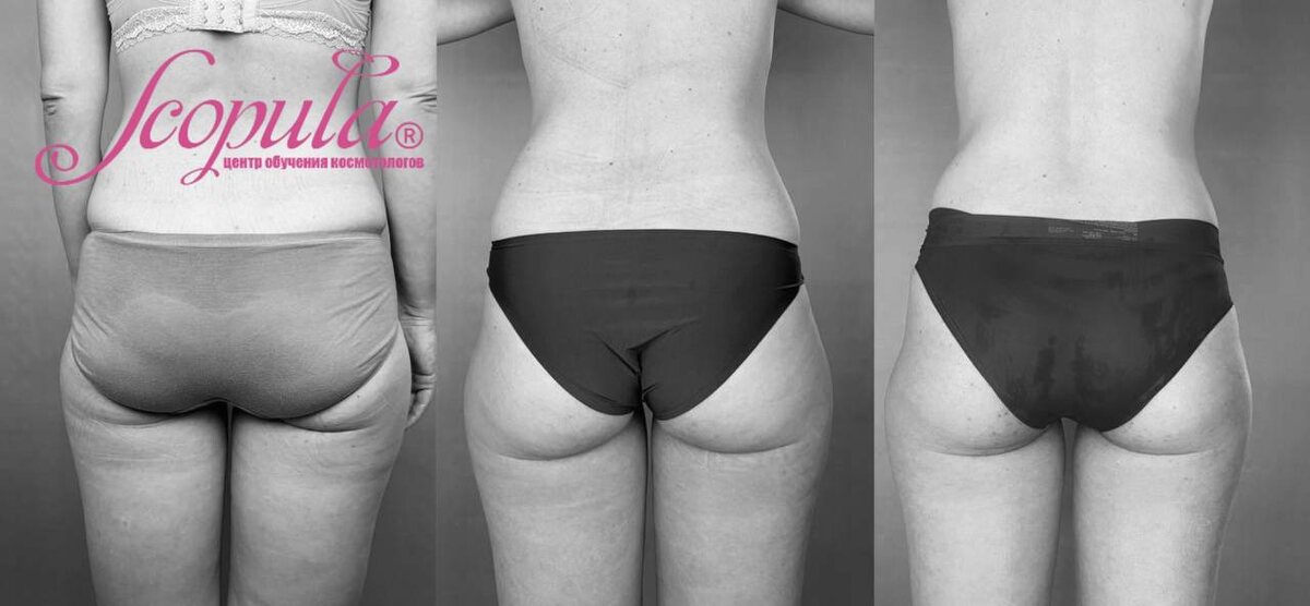 Пример фотопротоколирования процедур Центр обучения Scopula