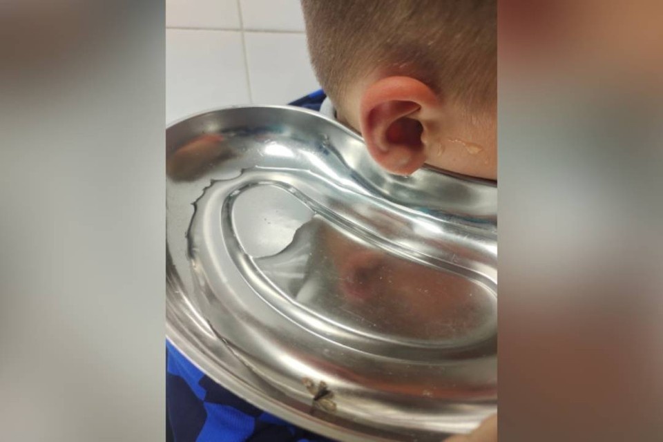    11-летний пациент, который жаловался на инородное тело в ухе. Фото: Елены Дабаевой