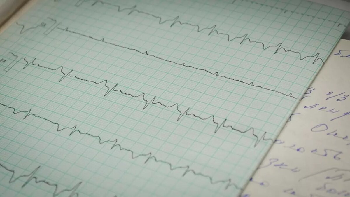     Источник: 1MI