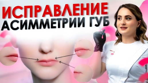 КАК УБРАТЬ АСИММЕТРИЮ И УВЕЛИЧИТЬ ГУБЫ | Контурная пластика губ