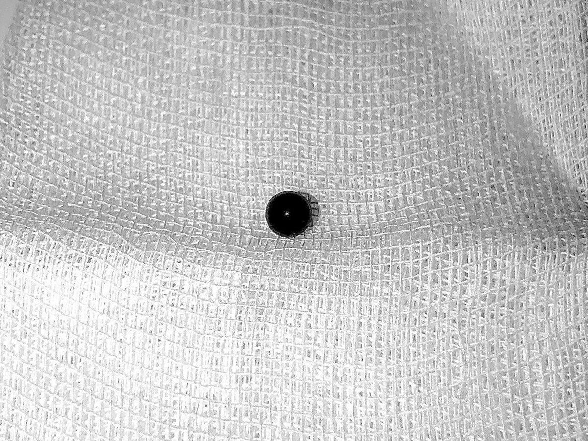    Игрушечная пуля, извлеченная из уха трехлетнего пациента специалистами Видновской больницы © Фото : Разборчивым почерком/Telegram